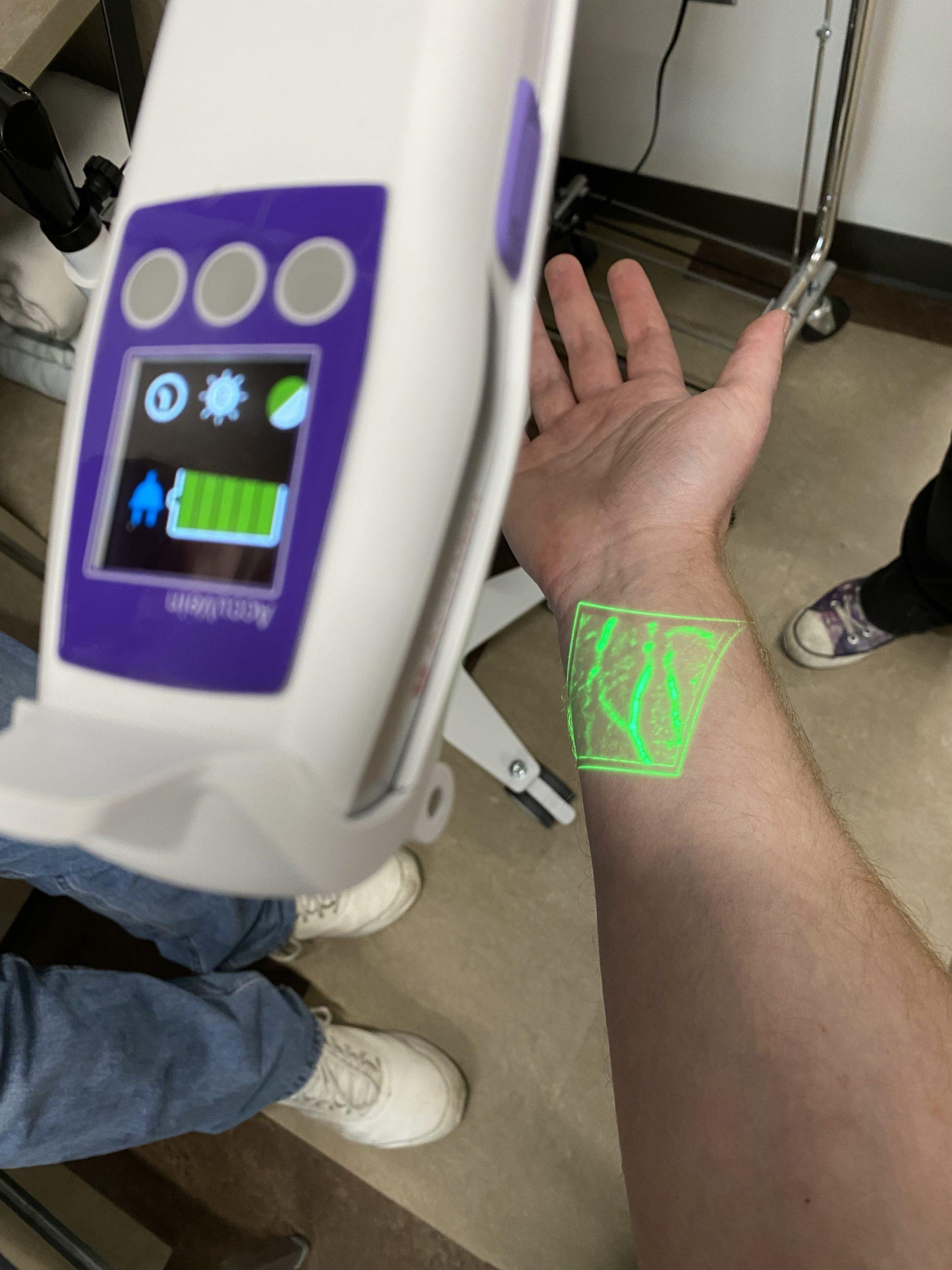 My arm, held palm up, underneath a white and purple device that is projecting a green image on my arm that shows exactly where my veins are.