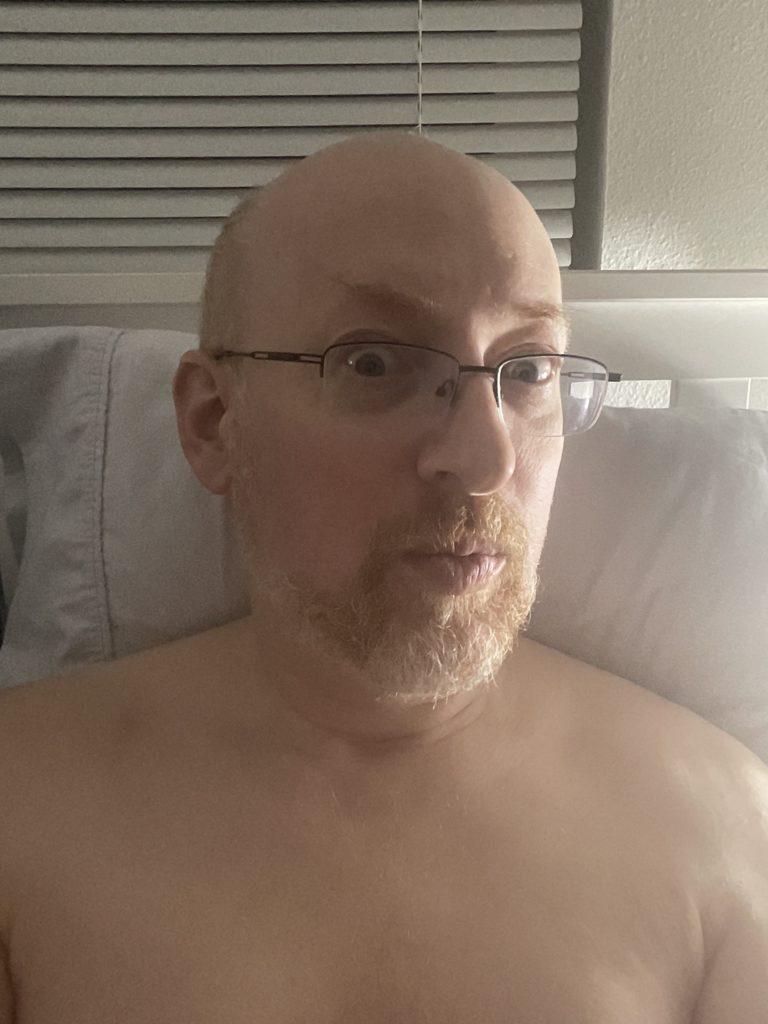 Me in bed, without a shirt, visible from the mid-chest up, making a silly “oooohh” face.